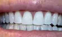 Bamboo Charcoal Teeth Whitening Powder